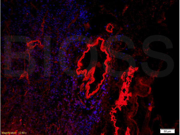 Formalin-fixed and paraffin embedded rat kidney tissue labeled with Anti-Collagen IV Polyclonal Antibody, Unconjugated (bs-4595R) at 1:200, followed by conjugation to the secondary antibody Goat Anti-Rabbit IgG, PE conjugated (bs-0295G-PE) used at 1:200 dilution for 40 minutes at 37°C. DAPI was used to stain the cell nuclei