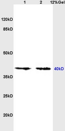 L1 mouse brain, L2 mouse kidney lysates probed (bs-0181R) at 1:200 in 4˚C. Followed by conjugation to secondary antibody (bs-0295G-HRP) at 1:3000 90min in 37˚C. Predicted band and observed band size: 40kDa.