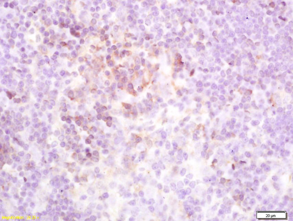 Formalin-fixed and paraffin embedded mouse spleen labeled with Rabbit Anti-TSHR Polyclonal Antibody (bs-0460R)at 1:200 followed by conjugation to the secondary antibody and DAB staining
