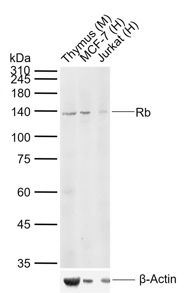 Lane 1: Mouse Thymus tissue lysates; Lane 2: Human MCF-7 cell lysates; Lane 3: Human Jurkat cell lysates probed with Rb Polyclonal Antibody, Unconjugated (bs-2777R) at 1:1000 dilution and 4\u00b0C overnight incubation. Followed by conjugated secondary antibody incubation at 1:20000 for 60 min at 37˚C.
