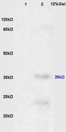 L1 mouse brain, L2 mouse liver lysates probed (bs-0593R) at 1:200 in 4˚C. Followed by conjugation to secondary antibody (bs-0295G-HRP) at 1:3000 90min in 37˚C. Observed band size: 32kDa.