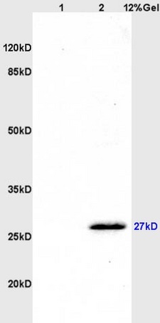 L1 rat brain, L2 rat kidney lysates probed (bs-2526R) at 1:200 in 4˚C. Followed by conjugation to secondary antibody (bs-0295G-HRP) at 1:3000 90min in 37˚C. Predicted and observed band size: 27kDa.