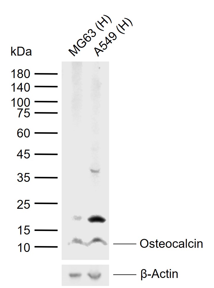 Lane 1: Human MG63 cell lysates; Lane 2: Human A549 cell lysates probed with Osteocalcin Polyclonal Antibody, Unconjugated (bs-4917R) at 1:1000 dilution and 4\u00b0C overnight incubation. Followed by conjugated secondary antibody incubation at 1:20000 for 60 min at 37˚C.