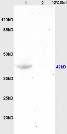 L1 human colon carcinoma, L2 mouse brain lysates probed (bs-1380R) at 1:200 in 4˚C. Followed by conjugation to secondary antibody (bs-0295G-HRP) at 1:3000 90min in 37˚C. Predicted and observed band size: 42kDa.\\n