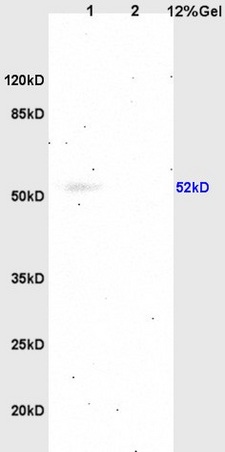 L1 rat brain, L2 human colon carcinoma lysates probed (bs-1056R) at 1:200 in 4˚C. Followed by conjugation to secondary antibody (bs-0295G-HRP) at 1:3000 90min in 37˚C. Predicted band and observed band size: 52kDa.
