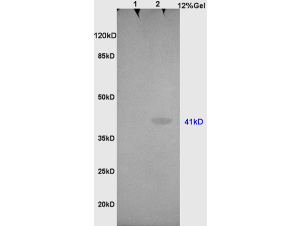 L1 rat brain, L2 , human colon carcinoma lysates probed (bs-0830R) at 1:200 in 4˚C. Followed by conjugation to secondary antibody (bs-0295G-HRP) at 1:3000 90min in 37˚C. Predicted and observed band size: 41kDa.