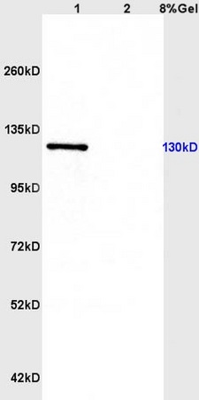 L1 rat brain, L2 mouse uterus lysates probed (bs-2527R) at 1:200 in 4˚C. Followed by conjugation to secondary antibody (bs-0295G-HRP) at 1:3000 90min in 37˚C. Predicted and observed band size: 130kDa.