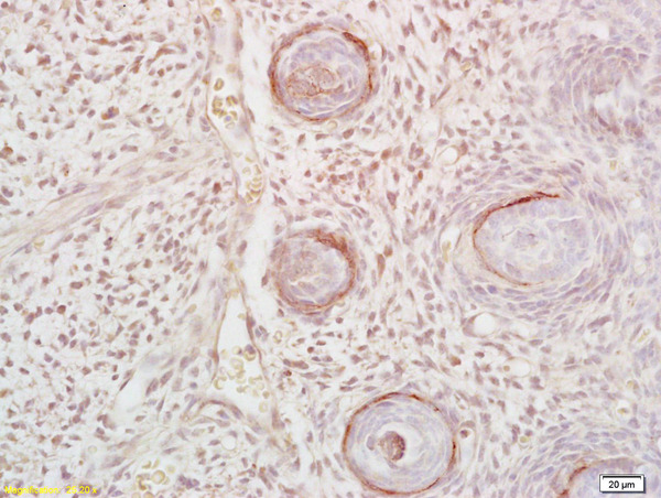Formalin-fixed and paraffin embedded mouse embryo tissue labeled with Anti-DLK1/DLL1 Polyclonal Antibody, Unconjugated (bs-2423R) at 1:200 followed by conjugation to the secondary antibody and DAB staining