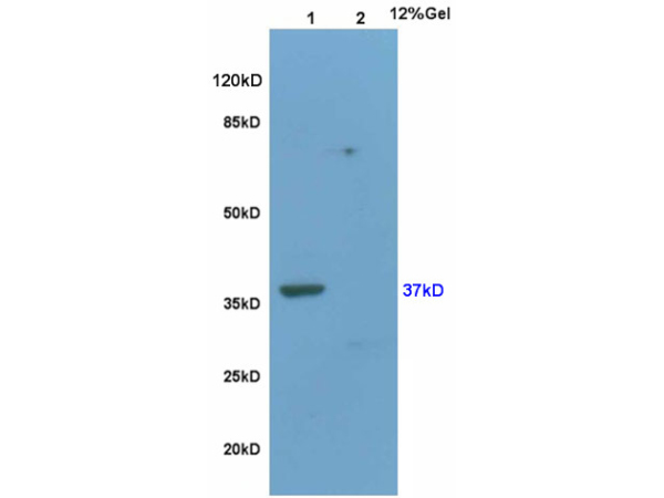 L1 rat brain, L2 mouse uterus lysates probed (bs-1700R) at 1:200 in 4˚C. Followed by conjugation to secondary antibody (bs-0295G-HRP) at 1:3000 90min in 37˚C. Predicted and observed band size: 37kDa.