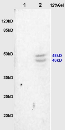 L1 rat heart, L2 rat brain lysates probed (bs-4172R) at 1:200 in 4˚C. Followed by conjugation to secondary antibody (bs-0295G-HRP) at 1:3000 90min in 37˚C. Predicted and observed band size: 46kDa.\n