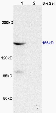 L1 rat heart, L2 rat brain lysates probed (bs-3031R) at 1:200 in 4˚C. Followed by conjugation to secondary antibody (bs-0295G-HRP) at 1:3000 90min in 37˚C. Predicted and observed band size: 155kDa.
