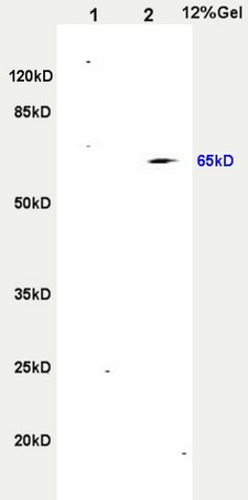 L1 rat heart, L2 rat brain lysates probed (bs-2695R) at 1:200 in 4˚C. Followed by conjugation to secondary antibody (bs-0295G-HRP) at 1:3000 90min in 37˚C. Predicted and observed band size: 65kDa. L1 rat heart, L2 rat brain lysates probed (bs-2695R) at 1:200 in 4˚C. Followed by conjugation to secondary antibody (bs-0295G-HRP) at 1:3000 90min in 37˚C. Predicted and observed band size: 65kDa.