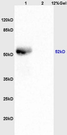 L1 human colon carcinoma lysates, L2 mouse brain lystaes probed (bs-5155R) at 1:200 in 4˚C. Followed by conjugation to secondary antibody (bs-0295G-HRP) at 1:3000 90min in 37˚C. Predicted and observed band size: 52kDa.\n
