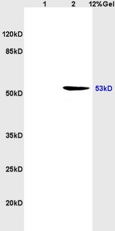 1 rat brain, L2 human colon carcinoma lysates probed (bs-0033R) at 1:200 in 4°C. Followed by conjugation to secondary antibody (bs-0295G-HRP) at 1:3000 90min in 37°C. Predicted band and observed band size: 53kDa.