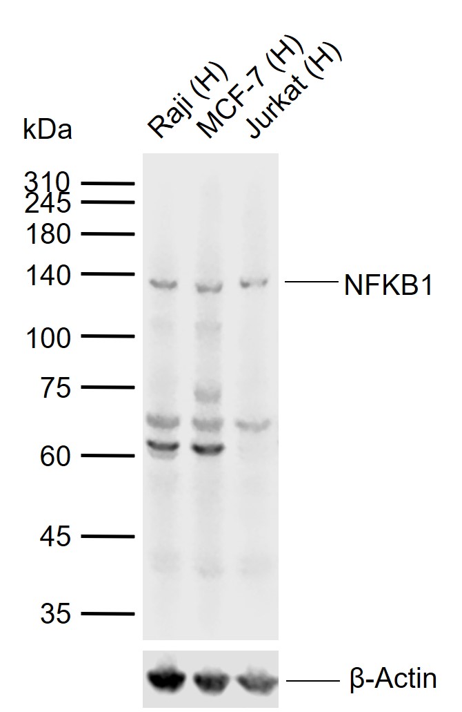 Lane 1: Human Raji cell lysates; Lane 2: Human MCF-7 cell lysates; Lane 3: Human Jurkat cell lysates probed with NFKB1 Polyclonal Antibody, Unconjugated (bs-1194R) at 1:1000 dilution and 4\u00b0C overnight incubation. Followed by conjugated secondary antibody incubation at 1:20000 for 60 min at 37˚C.