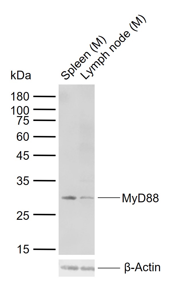 Lane 1: Mouse Spleen tissue lysates; Lane 2: Mouse Lymph node tissue lysates probed with MyD88 Polyclonal Antibody, Unconjugated (bs-1047R) at 1:200 dilution and 4\u00b0C overnight incubation. Followed by conjugated secondary antibody incubation at 1:20000 for 60 min at 37˚C.