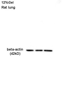 Rat lung lysate 30ug, probed (bs-0061R) at 1:200 overnight in 4˚C. Followed by conjugation to the secondary antibody (bs-0295G-HRP) at 1:3000 90min in 37˚C. Predicted and observed band size: 42kDa.