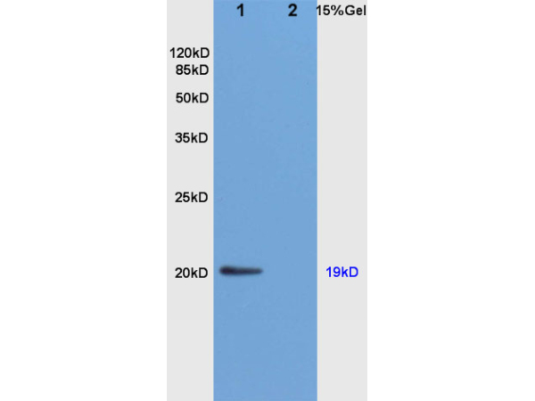 L1 rat brain, L2 rat liver lysates probed (bs-0075R) at 1:200 in 4˚C. Followed by conjugation to secondary antibody (bs-0295G-HRP) at 1:3000 90min in 37˚C. Predicted band and observed band size: 19kDa.