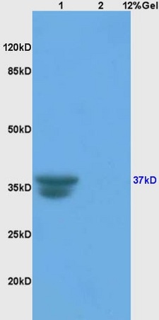 L1 rat liver, L2 rat brain lysates probed (bs-1508R) at 1:200 in 4˚C. Followed by conjugation to secondary antibody (bs-0295G-HRP) at 1:3000 90min in 37˚C. Predicted band and observed band size: 37kDa.