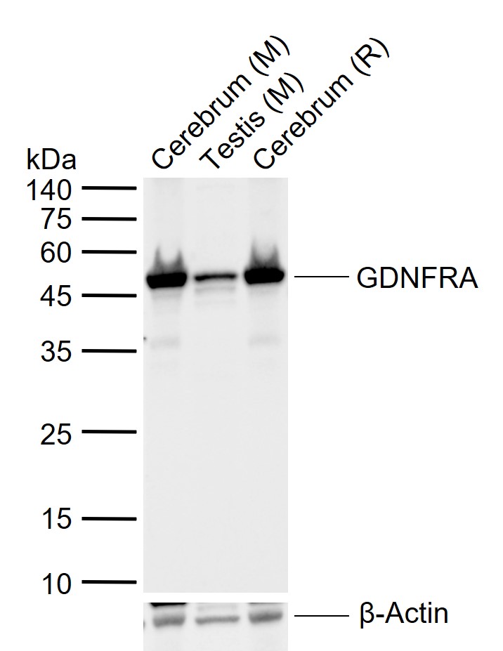 Lane 1: Mouse Cerebrum tissue lysates; Lane 2: Mouse Testis tissue lysates; Lane 3: Rat Cerebrum tissue lysates probed with GDNFRA Polyclonal Antibody, Unconjugated (bs-0201R) at 1:1000 dilution and 4\u00b0C overnight incubation. Followed by conjugated secondary antibody incubation at 1:20000 for 60 min at 37˚C.