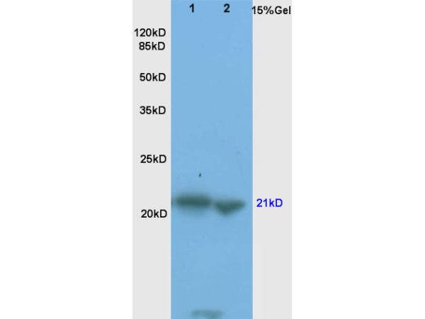 L1 rat brain, L2 mouse liver lysates probed (bs-0127R) at 1:200 in 4˚C. Followed by conjugation to secondary antibody (bs-0295G-HRP) at 1:3000 90min in 37˚C. Predicted band and observed band size: 21kDa.
