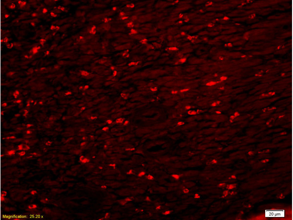 Formalin-fixed and paraffin embedded rat colitis tissue abeled with Anti-M2-PK Polyclonal Antibody, Unconjugated(bs-0102M) 1:200 followed by conjugation to the secondary antibody.