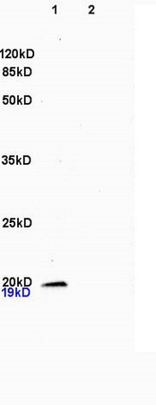 L1 rat brain, L2 rat heart lysates probed (bs-1023R) at 1:200 in 4˚C. Followed by conjugation to secondary antibody (bs-0295G-HRP) at 1:3000 90min in 37˚C. Predicted band and observed band size: 19kDa