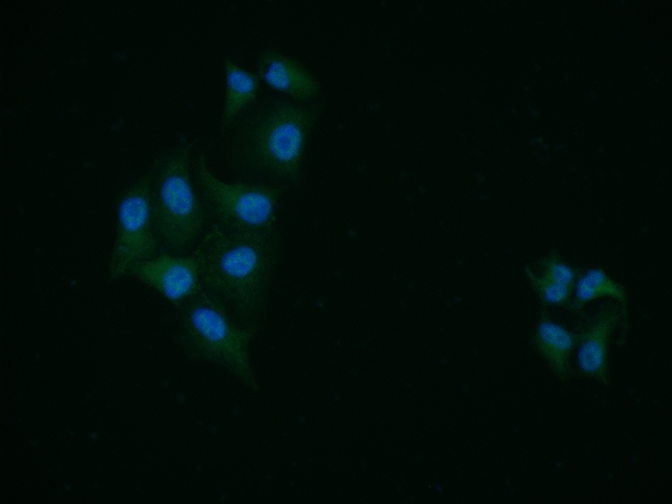 Hela cell; 4% Paraformaldehyde-fixed; Triton X-100 at room temperature for 20 min; Blocking buffer (normal goat serum, C-0005) at 37\u00b0C for 20 min; Antibody incubation with (p70 S6 Kinase Beta) polyclonal Antibody, Unconjugated (bs-3617R) 1:100, 90 minutes at 37\u00b0C; followed by a conjugated Goat Anti-Rabbit IgG antibody at 37\u00b0C for 90 minutes, DAPI (blue, C02-04002) was used to stain the cell nuclei.