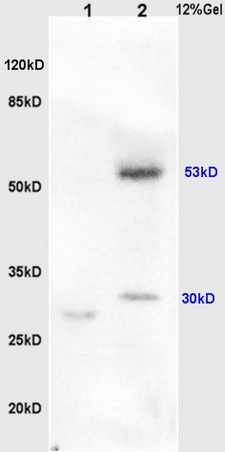 L1 rat lung, L2 human colon carcinoma lysates probed (bs-0976R) at 1:200 in 4˚C. Followed by conjugation to secondary antibody (bs-0295G-HRP) at 1:3000 90min in 37˚C. Predicted band and observed band size: 53kDa