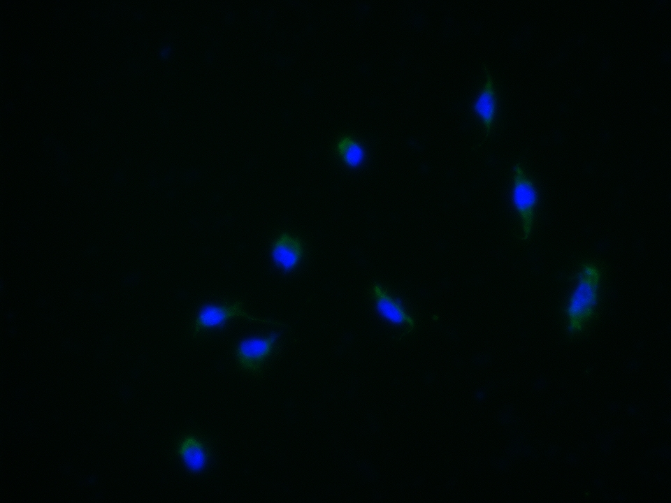 SH-SY5Y cell; 4% Paraformaldehyde-fixed; Triton X-100 at room temperature for 20 min; Blocking buffer (normal goat serum, C-0005) at 37\u00b0C for 20 min; Antibody incubation with (GABA A Receptor gamma 2) polyclonal Antibody, Unconjugated (bs-4112R) 1:25, 90 minutes at 37\u00b0C; followed by a conjugated Goat Anti-Rabbit IgG antibody at 37\u00b0C for 90 minutes, DAPI (blue, C02-04002) was used to stain the cell nuclei.