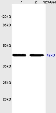 L1 rat heart, L2 rat brain lysates probed (bs-0828R) at 1:200 in 4˚C. Followed by conjugation to secondary antibody (bs-0295G-HRP) at 1:3000 90min in 37˚C. Predicted and observed band size: 42kDa.\n