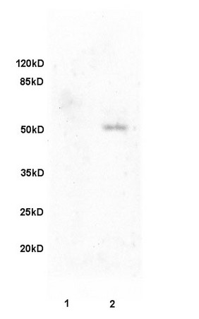 L1 rat brain, L2 human colon carcinoma lysates probed (bs-0810R) at 1:200 in 4˚C. Followed by conjugation to secondary antibody (bs-0295G-HRP) at 1:3000 90min in 37˚C. Predicted and observed band size: 50kDa.