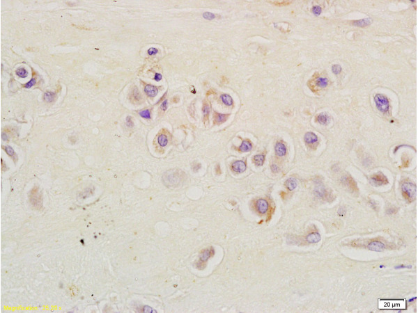 Formalin-fixed and paraffin embedded human placenta tissue labeled with Anti-CSIG Polyclonal Antibody, Unconjugated (bs-0793R) at 1:200 followed by conjugation to the secondary antibody and DAB staining