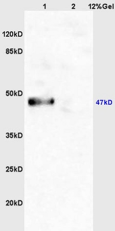 L1 mouse brain lysates L2 mouse heart lysates probed with Anti GSK-3 Beta (CT) Polyclonal Antibody, Unconjugated (bs-0028R) at 1:200 overnight at 4°C. Followed by conjugation to secondary antibody (bs-0295G-HRP) at 1:3000 for 90 min at 37°C. Predicted band 47kD. Observed band size:47kD.n