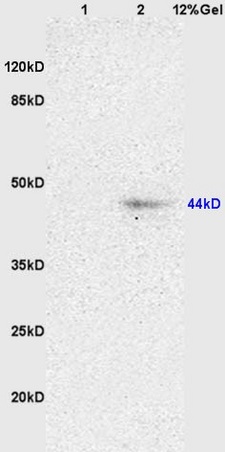 L1 rat brain lysates L2 rat heart lysates probed with Anti NK-2R/Neurokinin A Polyclonal Antibody, Unconjugated (bs-0123R) at 1:200 overnight at 4˚C. Followed by conjugation to secondary antibody (bs-0295G-HRP) at 1:3000 for 90 min at 37˚C. Predicted band 44kD. Observed band size:44kD.\n