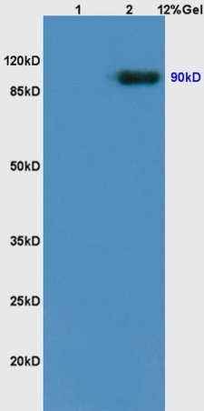 L1 rat brain lysates L2 rat kidney lysates probed with Anti Trk B/NTRK2 Polyclonal Antibody, Unconjugated (bs-0175R) at 1:200 overnight at 4˚C. Followed by conjugation to secondary antibody (bs-0295G-HRP) at 1:3000 for 90 min at 37˚C. Predicted band 90kD. Observed band size:90kD.\n