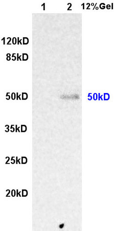 L1 rat kidney lysates L2 human colon carcinoma lysates probed with Anti ILK-1 Polyclonal Antibody, Unconjugated (bs-0317R) at 1:200 overnight at 4˚C. Followed by conjugation to secondary antibody (bs-0295G-HRP) at 1:3000 for 90 min at 37˚C. Predicted band 50kD. Observed band size:50kD.\\n