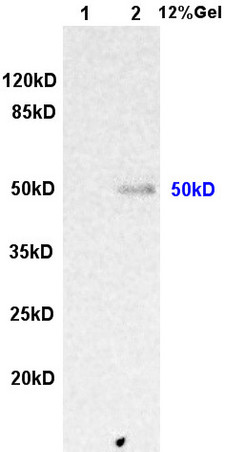 L1 rat kidney lysates L2 human colon carcinoma lysates probed with Anti ILK-1 Polyclonal Antibody, Unconjugated (bs-0317R) at 1:200 overnight at 4˚C. Followed by conjugation to secondary antibody (bs-0295G-HRP) at 1:3000 for 90 min at 37˚C. Predicted band 50kD. Observed band size:50kD.\n