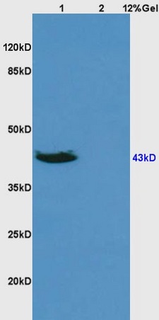 L1 human colon carcinoma lysates L2 rat brain lysates probed with Anti DR3\/APO3\/TWEAK Polyclonal Antibody, Unconjugated (bs-0421R) at 1:200 overnight at 4˚C. Followed by conjugation to secondary antibody (bs-0295G-HRP) at 1:3000 for 90 min at 37˚C. Predicted band 43kD. Observed band size:43kD.\\n