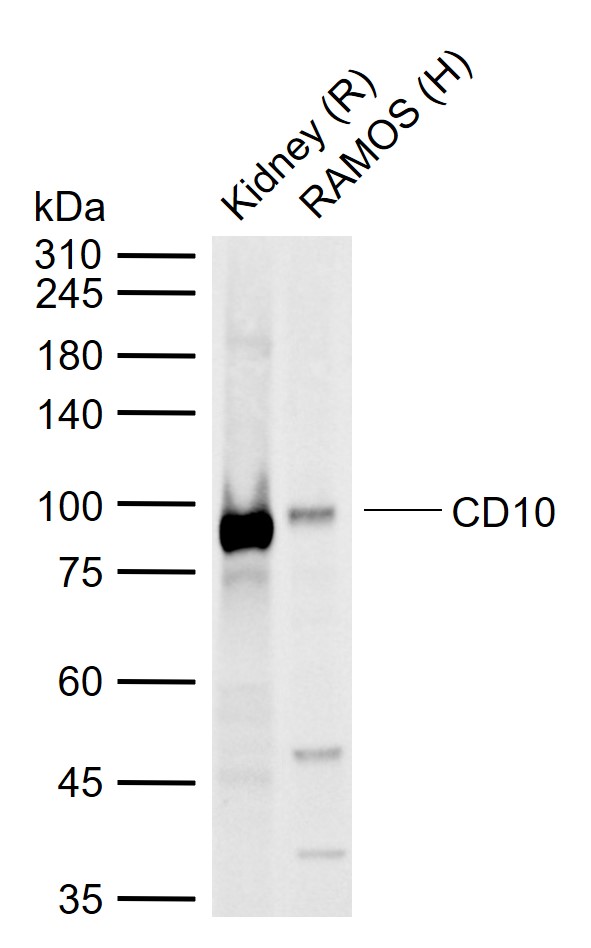 Lane 1: Rat Kidney tissue lysates; Lane 2: Human RAMOS cell lysates probed with CD10 Polyclonal Antibody, Unconjugated (bs-0527R) at 1:1000 dilution and 4\u00b0C overnight incubation. Followed by conjugated secondary antibody incubation at 1:20000 for 60 min at 37˚C.