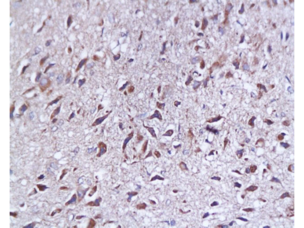 Formalin-fixed and paraffin embedded rat brain tissue labeled with Anti-SYP p38\/Synaptophysin\/SAP-1 Polyclonal Antibody, Unconjugated (bs-0121R)  at 1:200, followed by conjugation to the secondary antibody and DAB staining