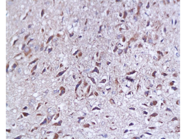 Formalin-fixed and paraffin embedded rat brain tissue labeled with Anti-SYP p38/Synaptophysin/SAP-1 Polyclonal Antibody, Unconjugated (bs-0121R) at 1:200, followed by conjugation to the secondary antibody and DAB staining