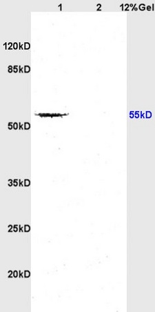 L1 rat brain lysates L2 mouse embryo lysates probed with Anti TGF Beta R1/TGFBR1 Polyclonal Antibody, Unconjugated (bs-0638R) at 1:200 overnight at 4˚C. Followed by conjugation to secondary antibody (bs-0295G-HRP) at 1:3000 for 90 min at 37˚C. Predicted band 55kD. Observed band size:55kD.\n