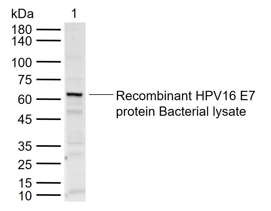 Lane 1: Recombinant HPV16 E7 protein Bacterial lysate, DsbC & His(bs-49101L) probed with HPV16 E7 Polyclonal Antibody, Unconjugated (bs-10446R) at 1:1000 dilution and 4\u00b0C overnight incubation. Followed by conjugated secondary antibody incubation at 1:20000 for 60 min at 37˚C.
