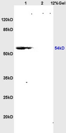 L1 rat brain lysates L2 rat kidney lysates probed with Anti CSIG Polyclonal Antibody, Unconjugated (bs-0793R) at 1:200 overnight at 4˚C. Followed by conjugation to secondary antibody (bs-0295G-HRP) at 1:3000 for 90 min at 37˚C. Predicted band 54-60kD. Observed band size:54kD.\n
