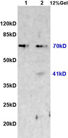 L1 rat heart lysates L2 rat brain lysates probed with Anti CX3CL1 Polyclonal Antibody, Unconjugated (bs-0811R) at 1:200 overnight at 4˚C. Followed by conjugation to secondary antibody (bs-0295G-HRP) at 1:3000 for 90 min at 37˚C. Predicted band 41kD. Observed band size:41/70kD.