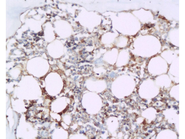 Formalin-fixed and paraffin embedded rat tibia tissue labeled with Anti-BMP2 Polyclonal Antibody, Unconjugated (bs-1012R) at 1:200 followed by conjugation to the secondary antibody and DAB staining