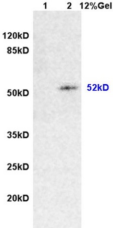 L1 rat brain lysates L2 rat intestine lysates probed with Anti Desmin\/DES Polyclonal Antibody, Unconjugated (bs-1026R) at 1:200 overnight at 4˚C. Followed by conjugation to secondary antibody (bs-0295G-HRP) at 1:3000 for 90 min at 37˚C. Predicted band 52kD. Observed band size:52kD.\\n