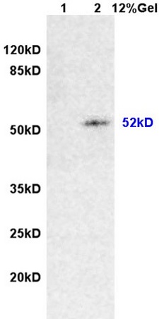 L1 rat brain lysates L2 rat intestine lysates probed with Anti Desmin/DES Polyclonal Antibody, Unconjugated (bs-1026R) at 1:200 overnight at 4˚C. Followed by conjugation to secondary antibody (bs-0295G-HRP) at 1:3000 for 90 min at 37˚C. Predicted band 52kD. Observed band size:52kD.\n