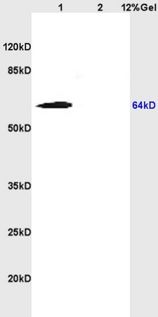 L1 rat heart lysates L2 rat heart lysates probed with Anti Cytokeratin 5/CK5 Polyclonal Antibody, Unconjugated (bs-1060R) at 1:200 overnight at 4˚C. Followed by conjugation to secondary antibody (bs-0295G-HRP) at 1:3000 for 90 min at 37˚C. Predicted band 64kD. Observed band size:64kD.\n